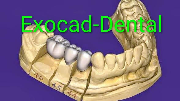 Exocad-Dental 