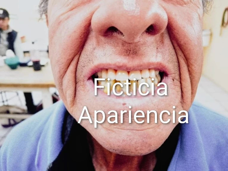 Ficticia Apariencia Dental 